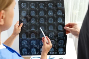 doctor examining brain scan